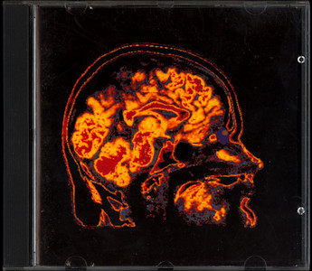 pk099cd0