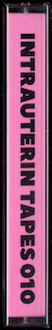 intrauterintapes010mc03